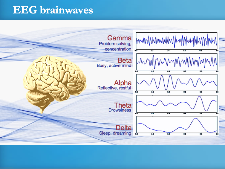 EEG+Brain+Waves.png