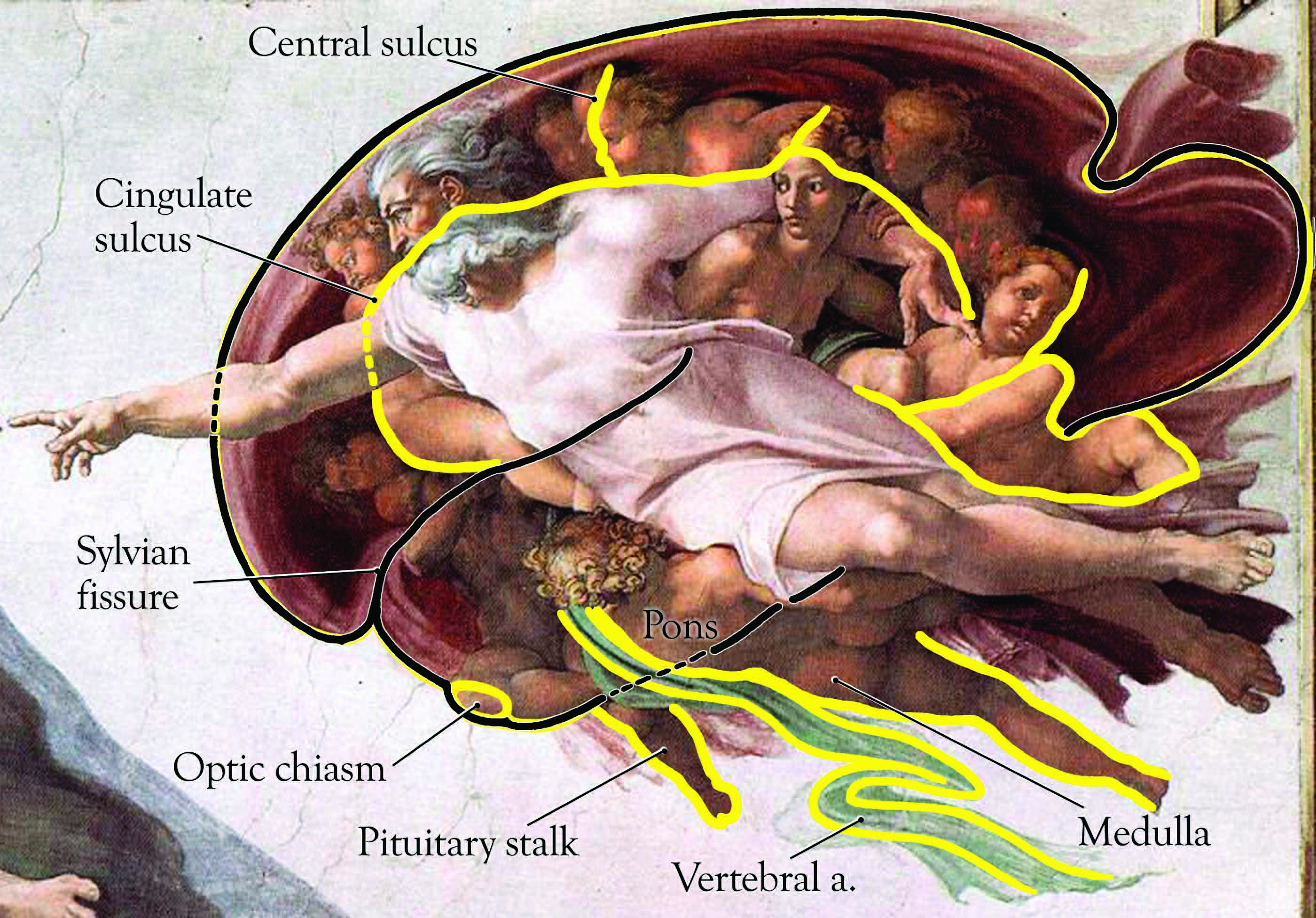 Michelangelo-Sistine-Chapel-Adam-Brain-.jpg